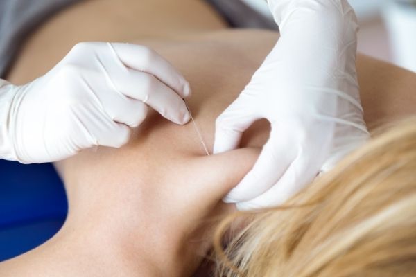 What Are Trigger Point Injections?